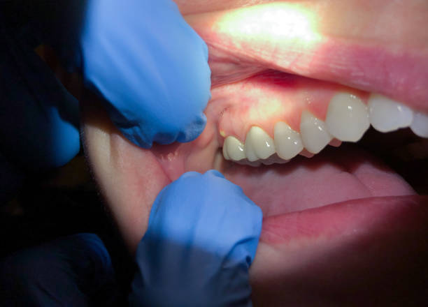 Best Same-Day Emergency Dentist in Marion, KY