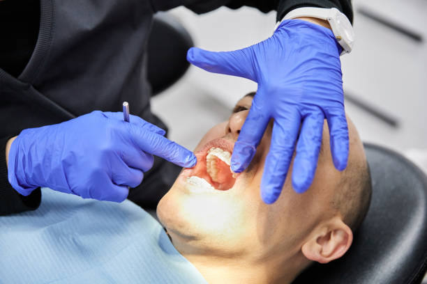 Best Emergency Tooth Extraction in Marion, KY