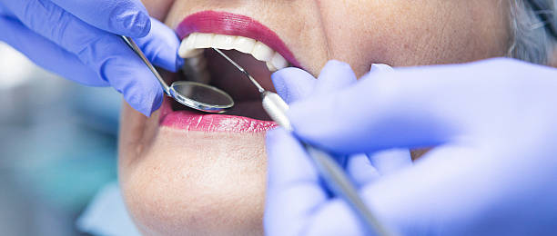 Best Emergency Broken Tooth Repair in Marion, KY